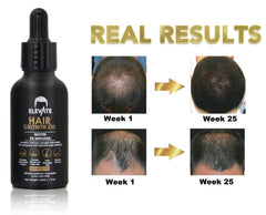 Elevate scalp massage application demonstrates soothing technique to evenly distribute nutrients for healthier roots