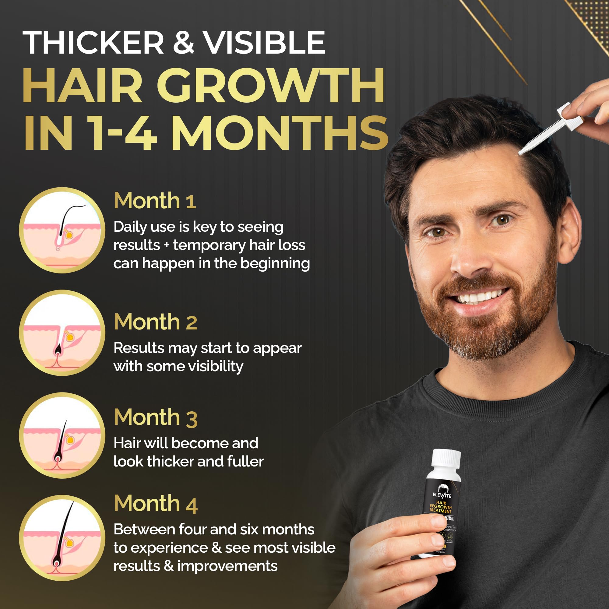 Elevate scalp thinning region illustrates targeted use for thinning areas