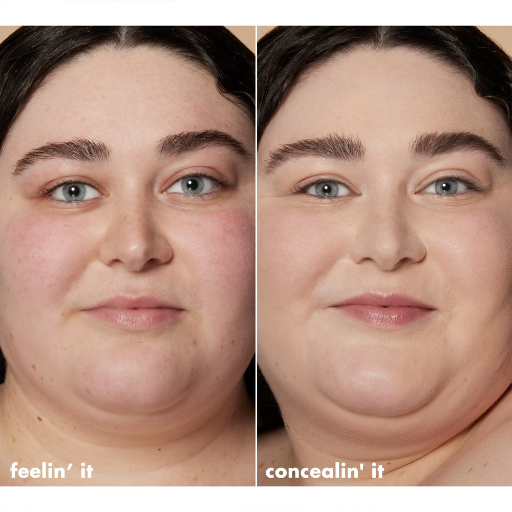 e.l.f. Hydrating Camo Concealer masking blemishes with a satin finish.