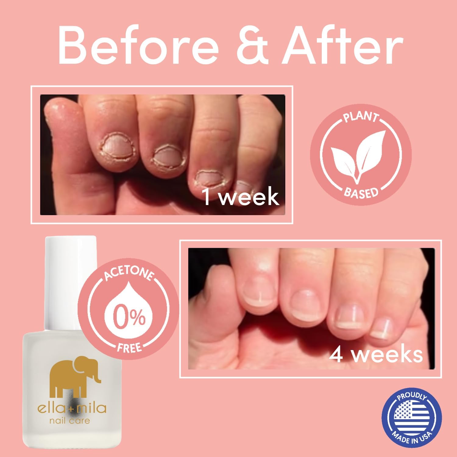 ella-mila No More Biting adults-hands illustrates universal use for teens and adults