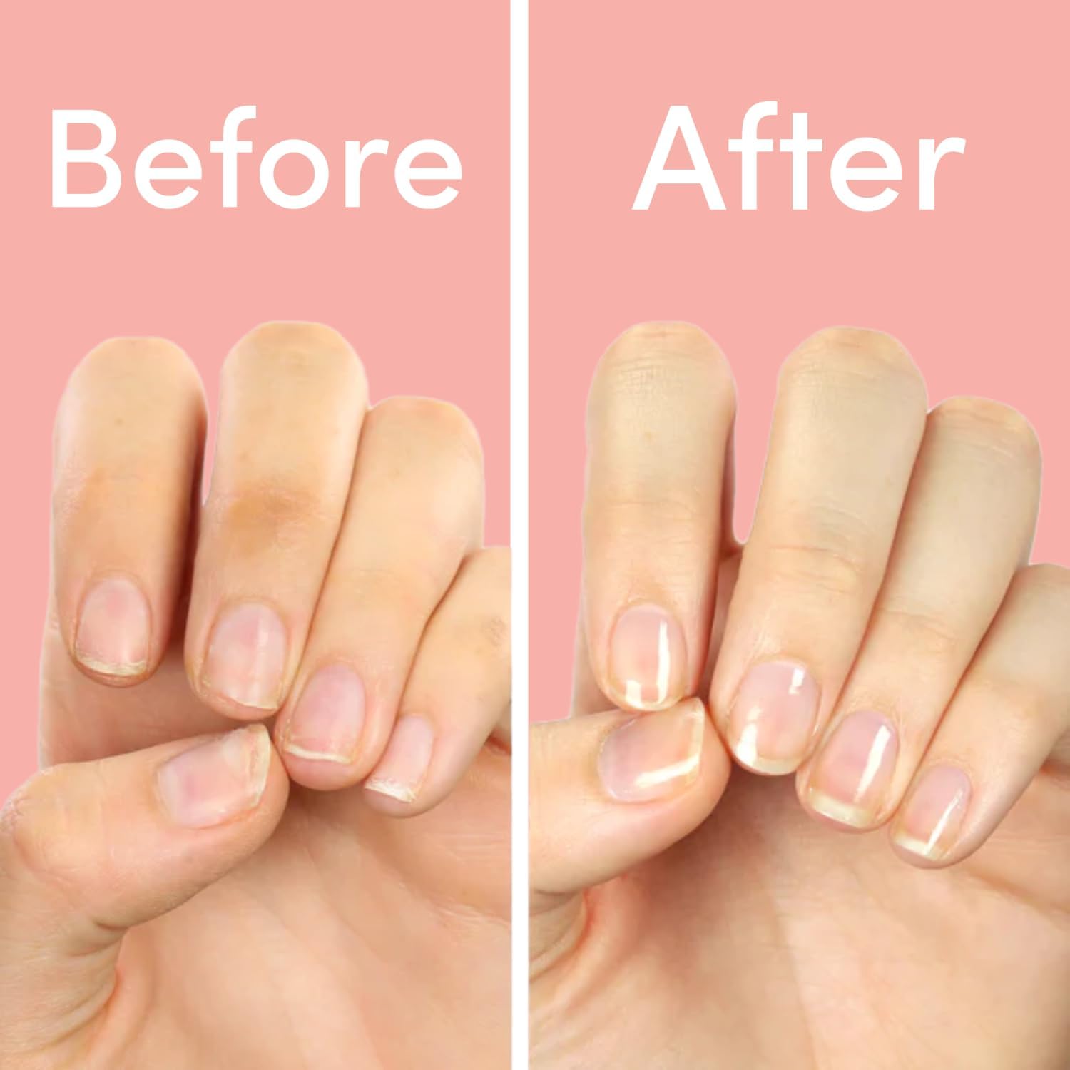 ella+mila First Aid Kiss before-after nails progress visualization offers growth insight