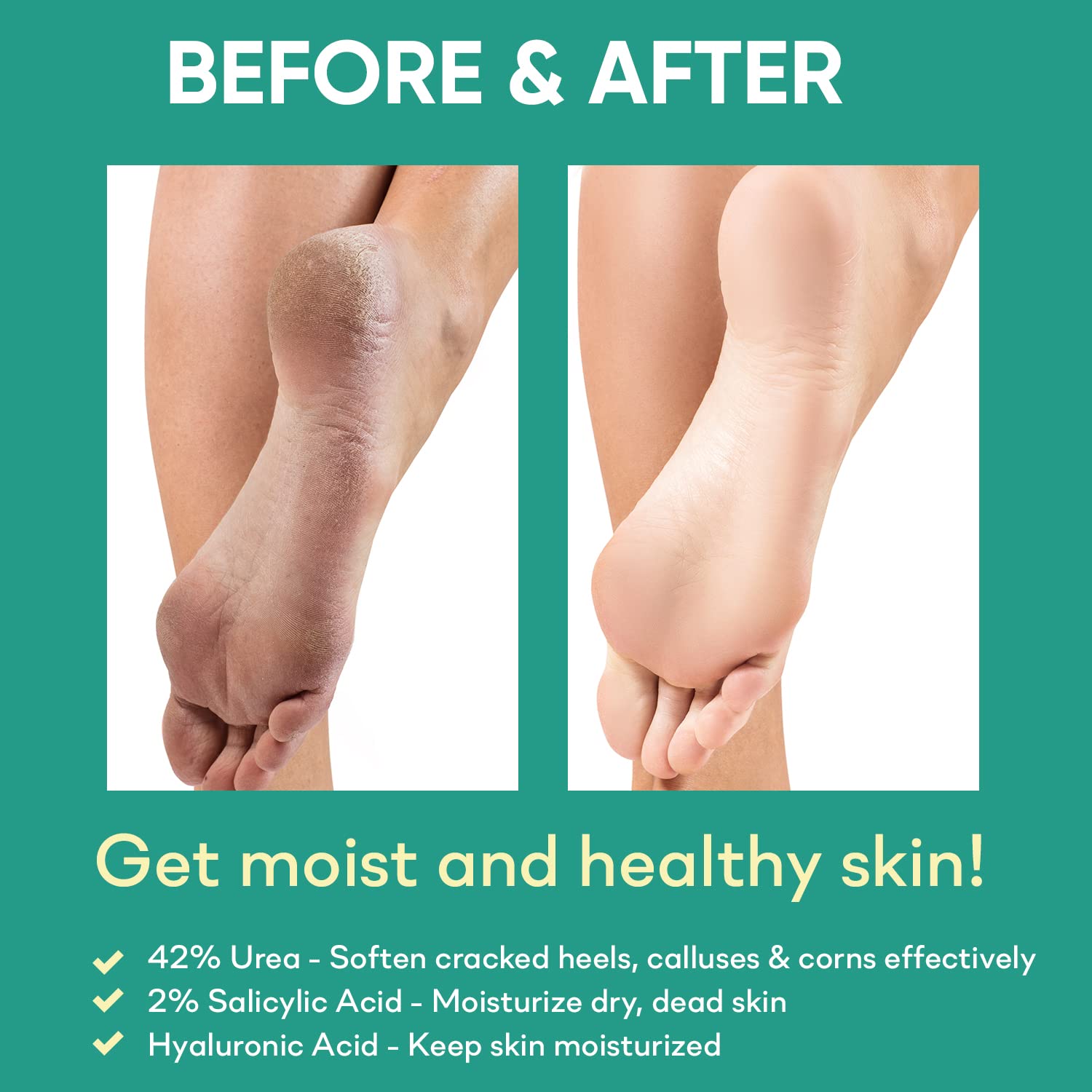 Ellocy foot-care routine steps for simple daily skin maintenance