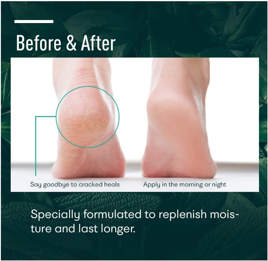 Ellocy Urea Foot Cream spread on foot demonstrates quick absorption