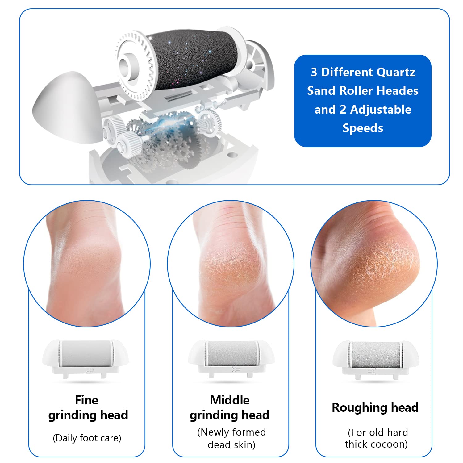 Elmchee foot callus remover with two speeds for gentle or thorough exfoliation.