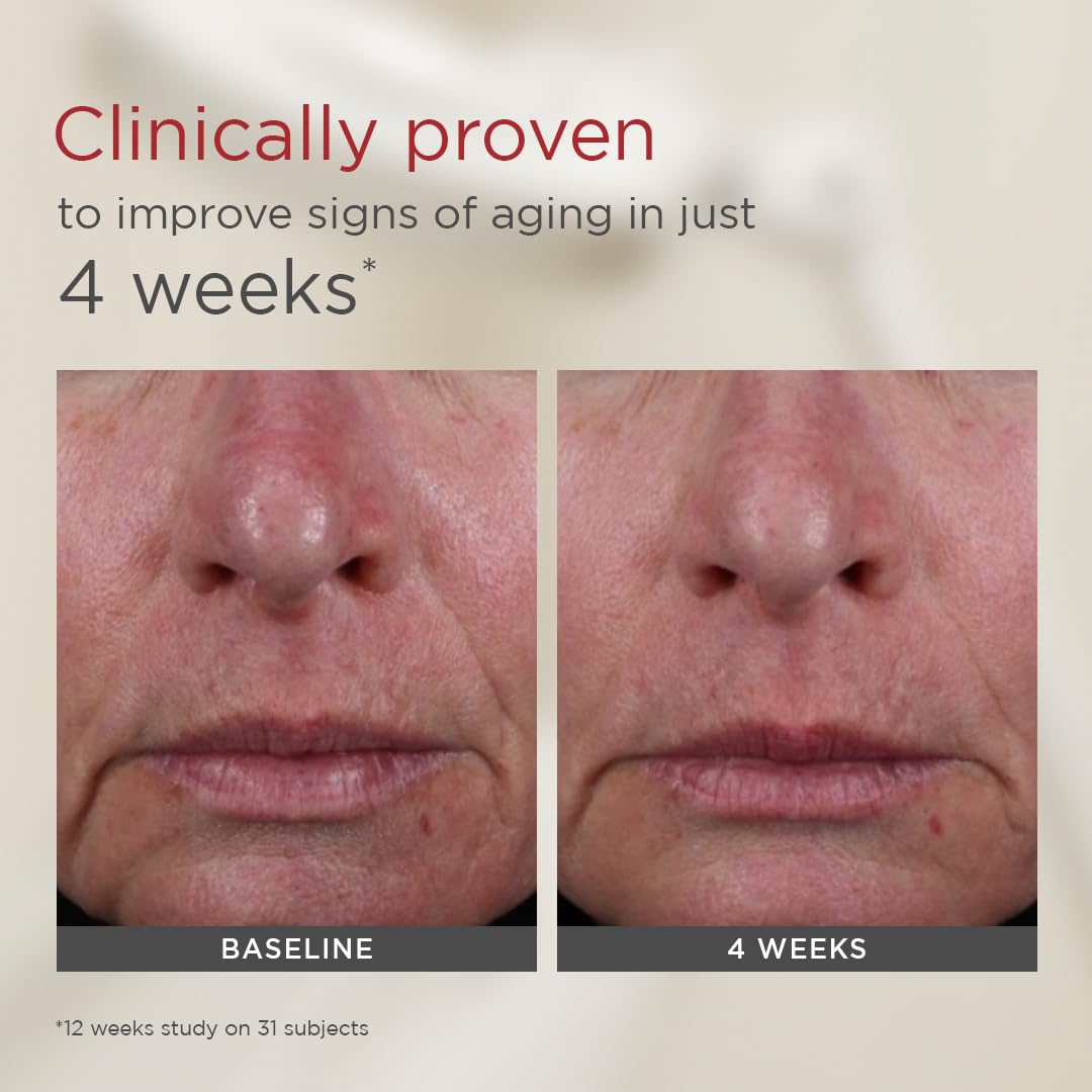 EltaMD UV AOX Elements even skin-tone blur on cheek.