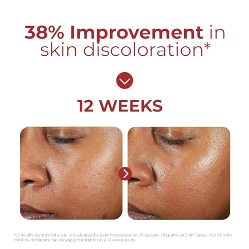 EltaMD UV Clear transparent finish on skin for natural look