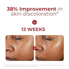 EltaMD UV Clear transparent finish on skin for natural look