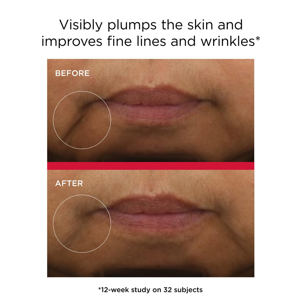 EltaMD UV Daily Hydration+ on-face application showcases smooth blend.