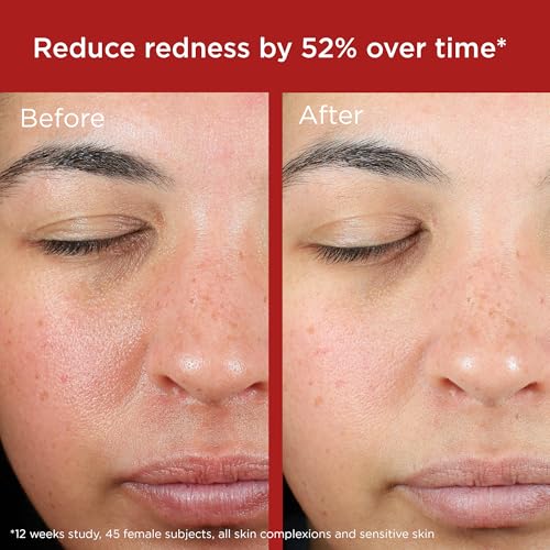 EltaMD Green Tint application shown for sensitive skin in daily routine.