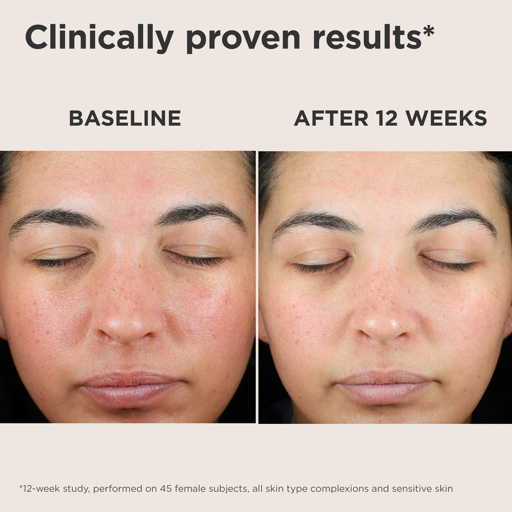 EltaMD UV Skin Recovery texture on skin shows protective mineral shield.
