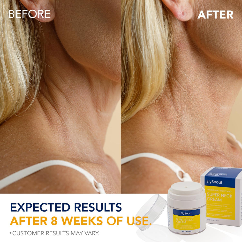 ElySeoul silk-glow skin depiction suggests a hydrated, radiant neck appearance.
