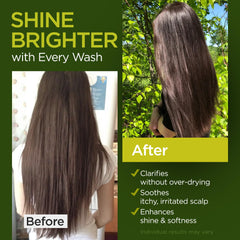 Ember Cloud Tea Tree Rosemary Conditioner bottle delivers soothing hydration for dry scalp.