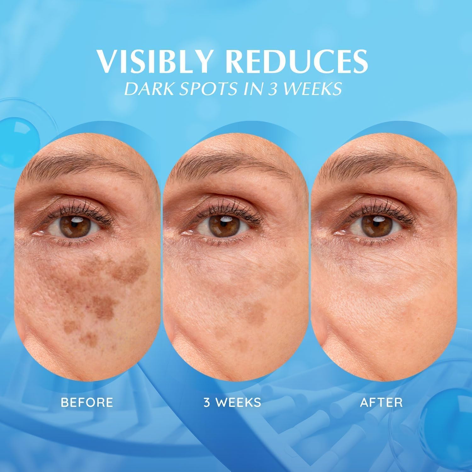 EnaSkin Dark Spot Remover bottle pump highlights convenient twice-daily application.