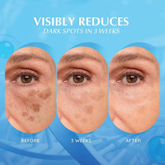 EnaSkin Dark Spot Remover bottle pump highlights convenient twice-daily application.
