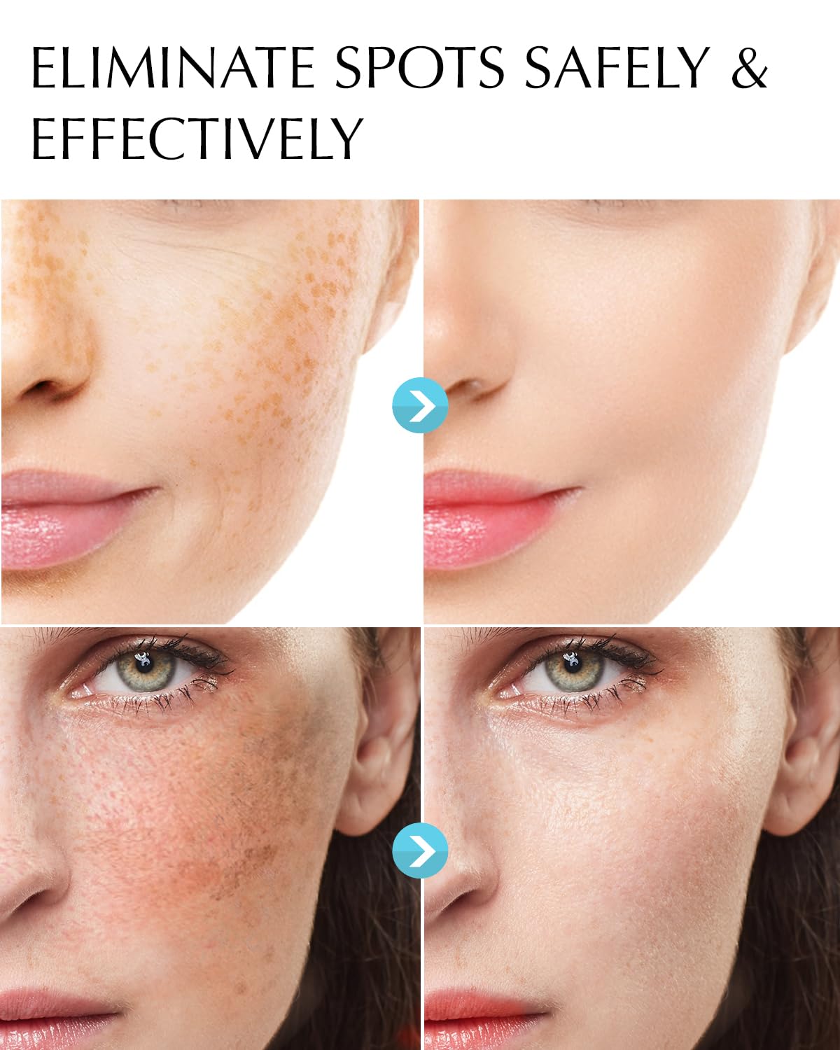 EnaSkin dark spot remover cream texture close-up for smoothing skin.