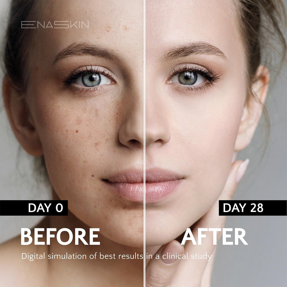 EnaSkin Dark Spot Serum dispenses drops for targeted application and hydration.