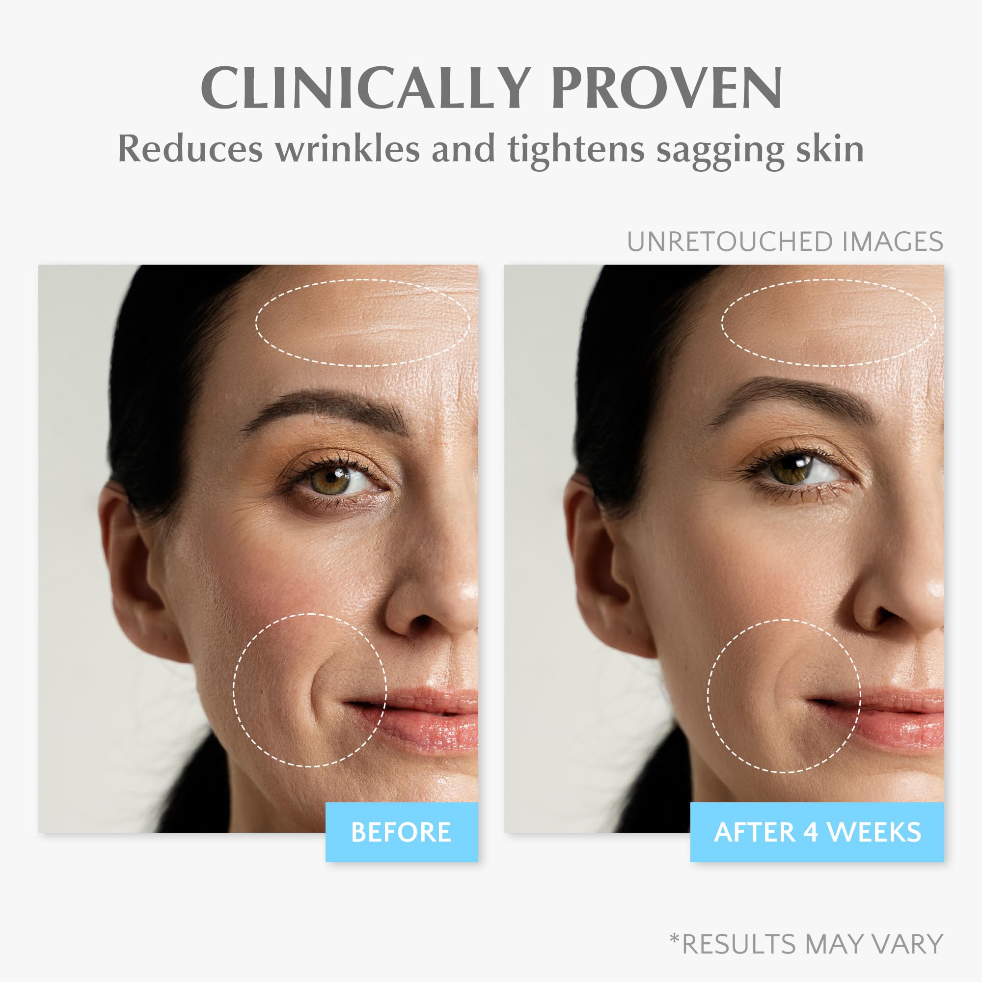 EnaSkin hyaluronic acid 7 percent drops demonstrate intense hydration and plumping