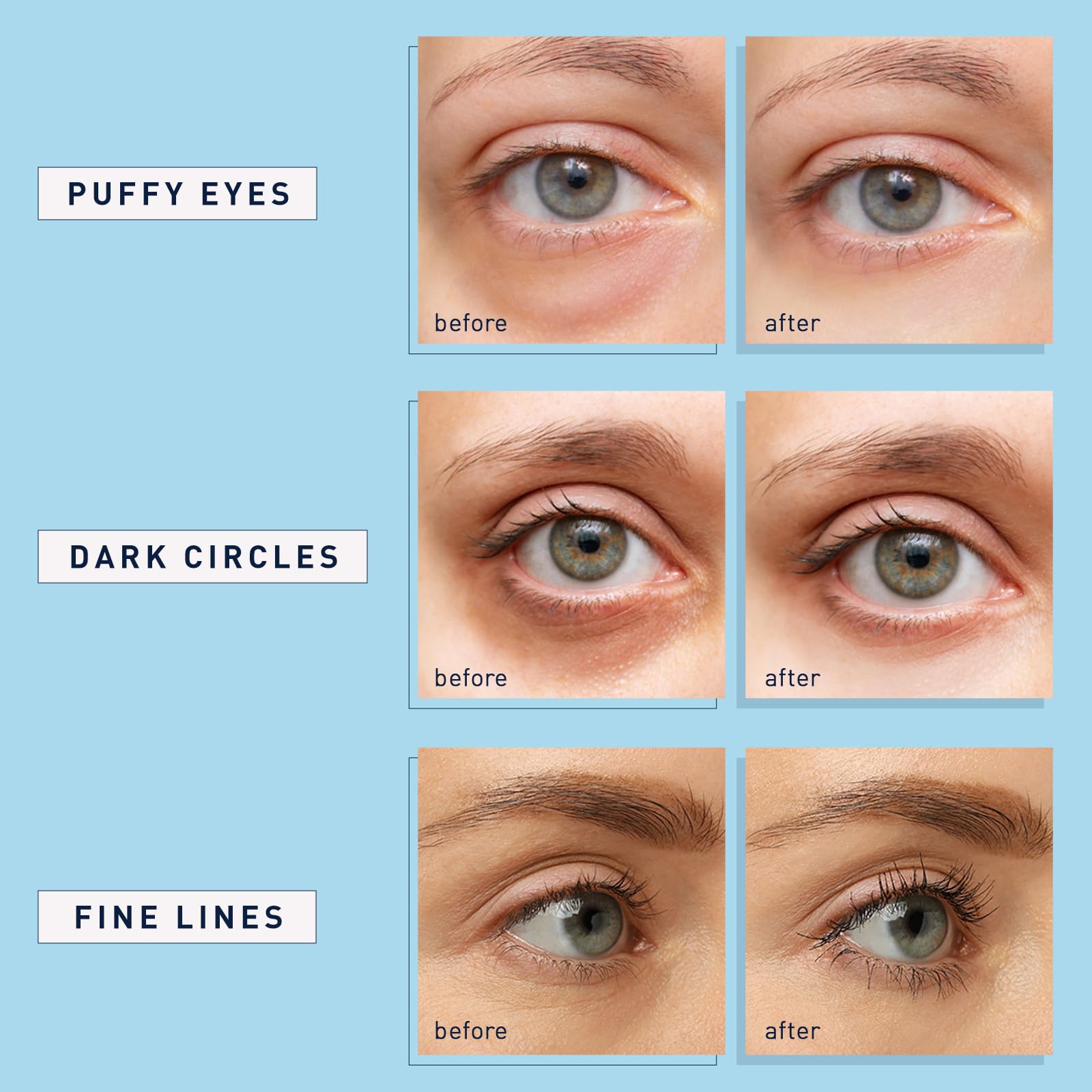 Enaskin Naturals morning routine with eye patches refreshed appearance