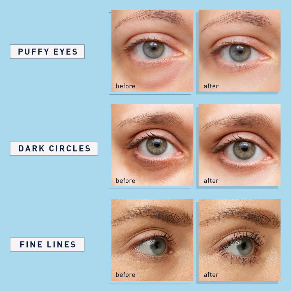 Enaskin Naturals morning routine with eye patches refreshed appearance
