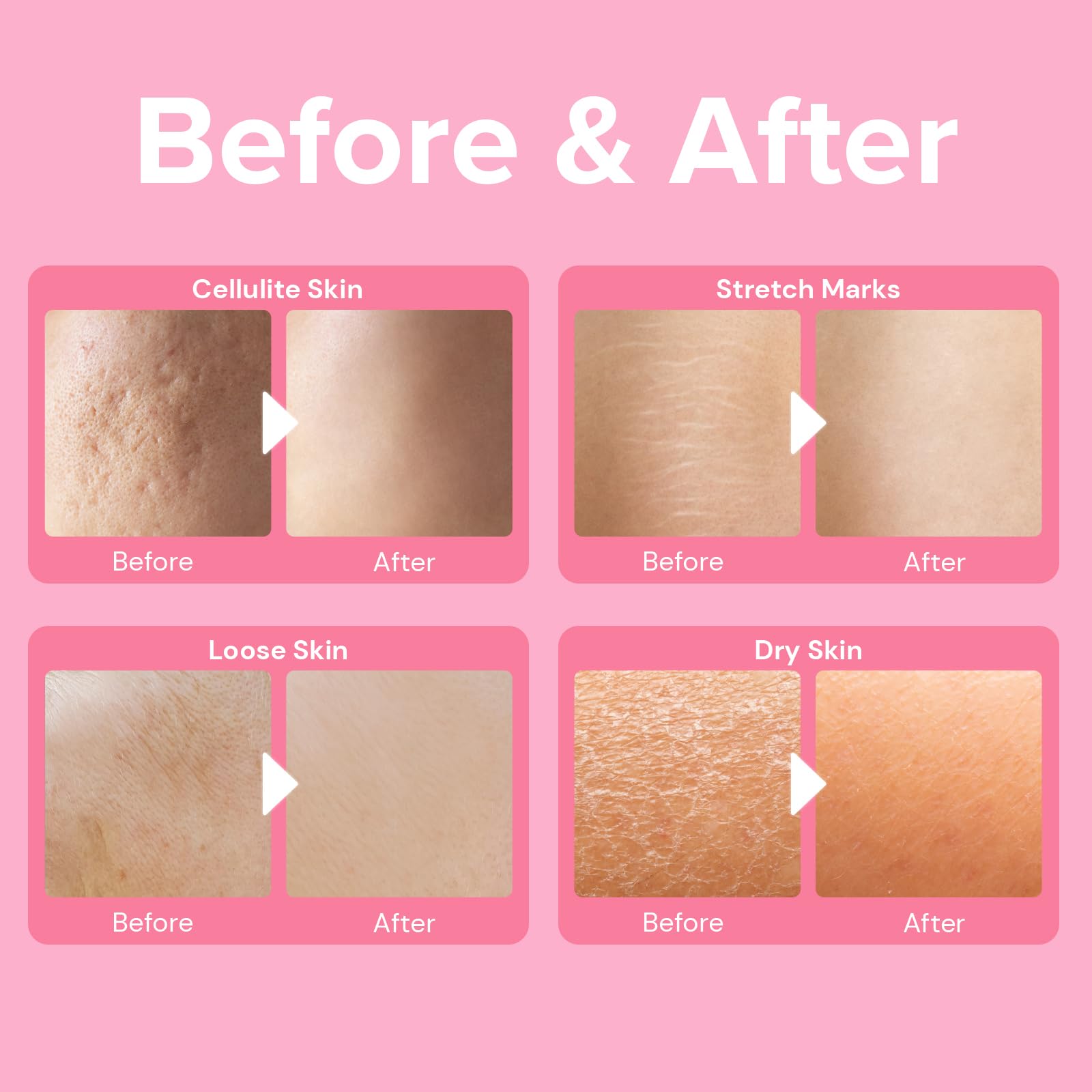 Enaskin Naturals deep collagen boost action highlights visible tightening in a lab-tested context.