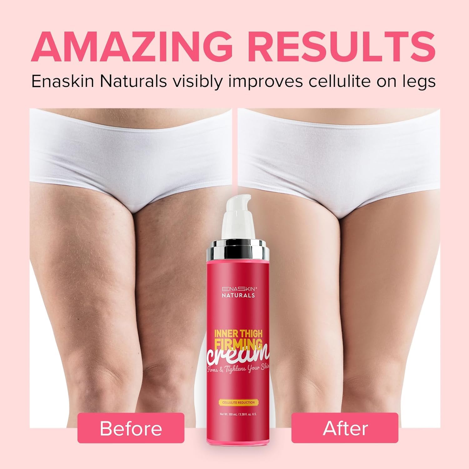 Enaskin Naturals inner thigh firming cream with collagen peptides for a tighter look.