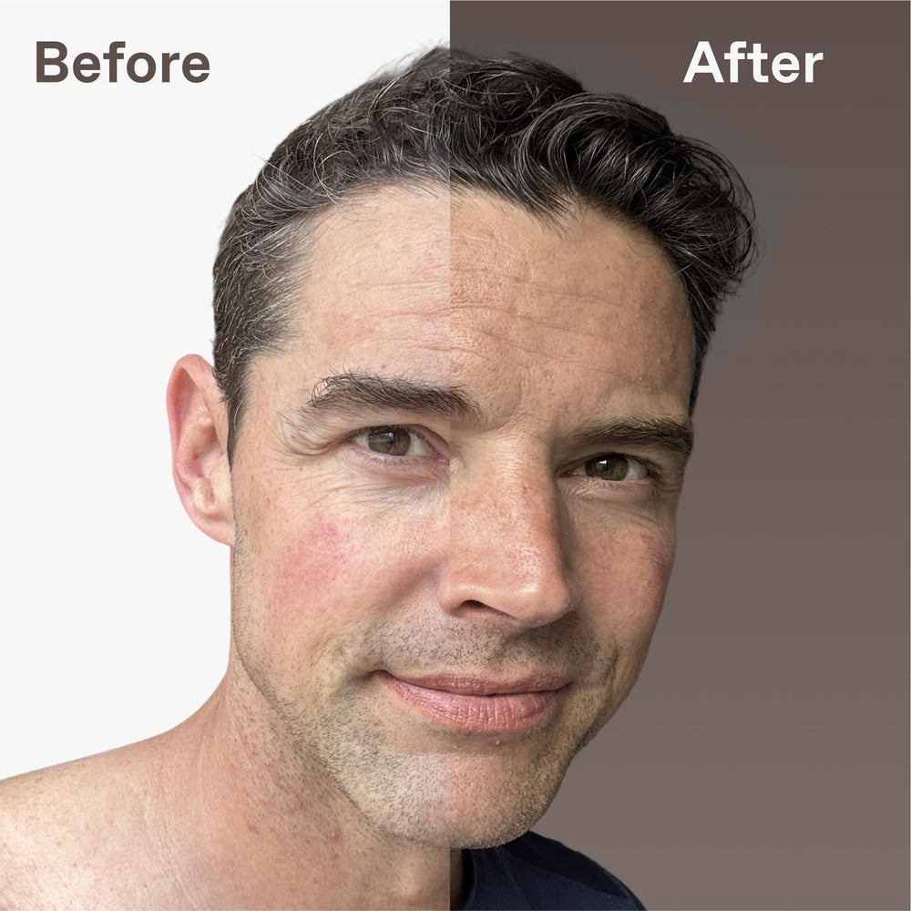 ENHANSE Hyaluronic Acid hydrates skin during application.