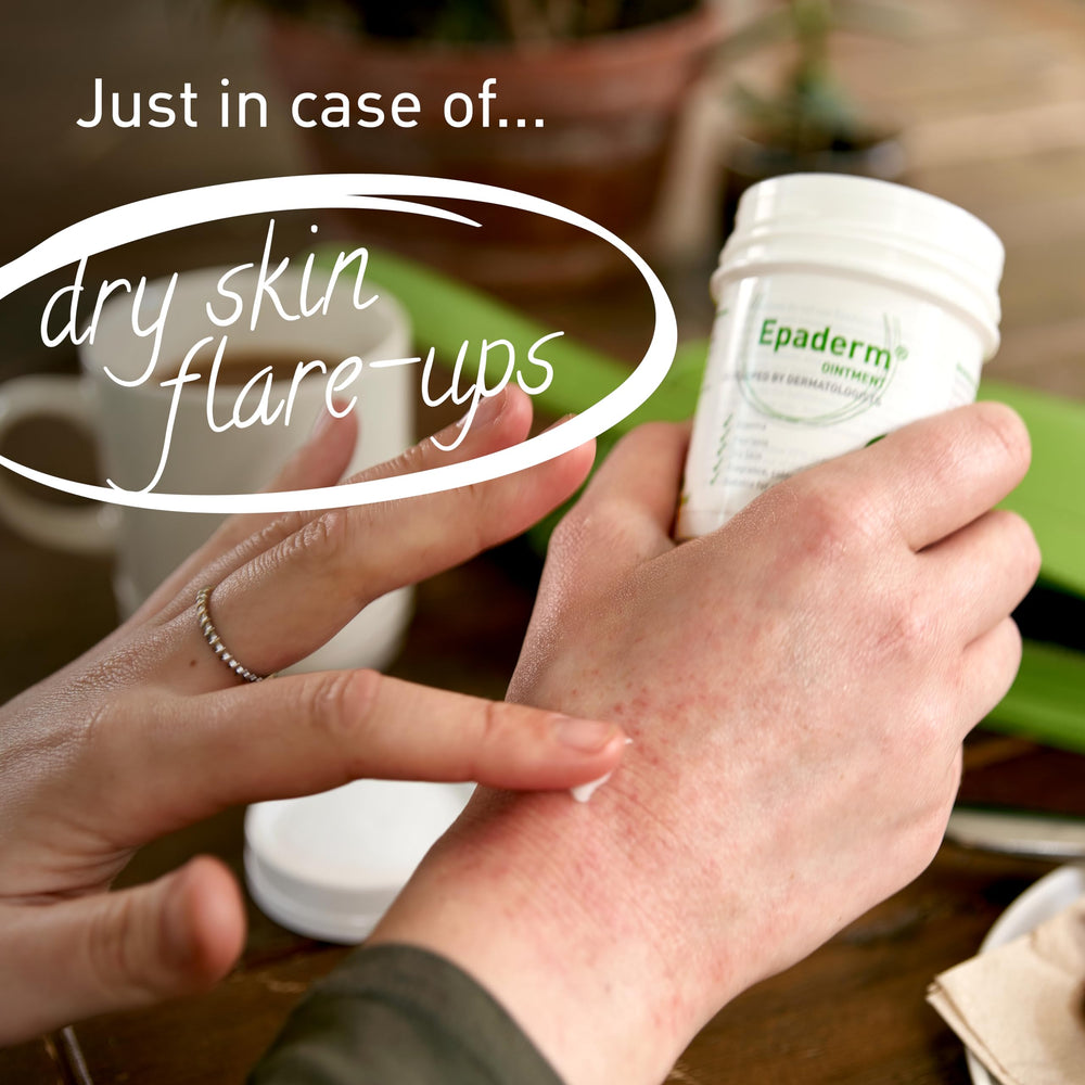 Epaderm ointment placed beside eczema-prone areas for dermatitis care routines.