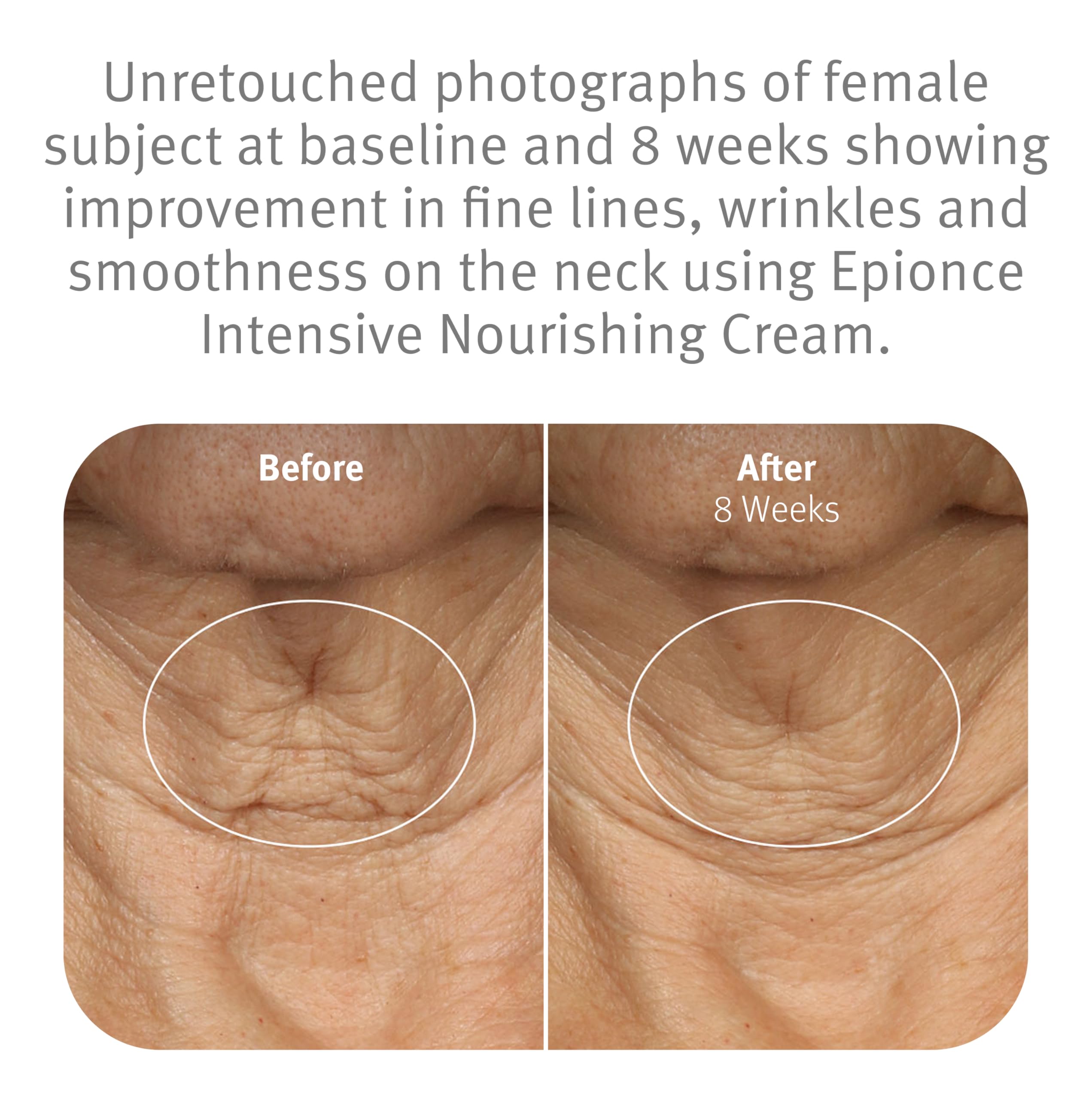 Epionce Intensive Nourishing Cream on the face during application shows comfortable spread.