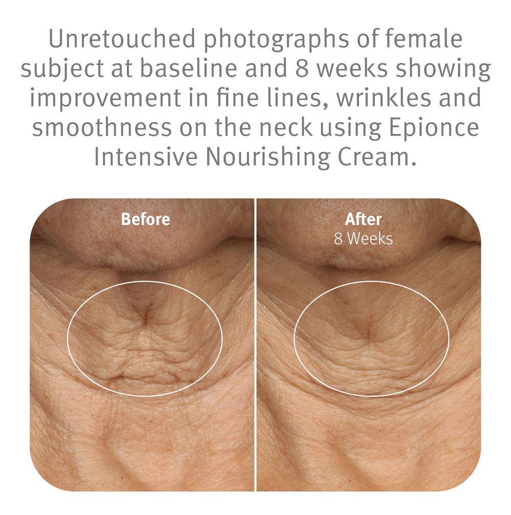Epionce Intensive Nourishing Cream on the face during application shows comfortable spread.