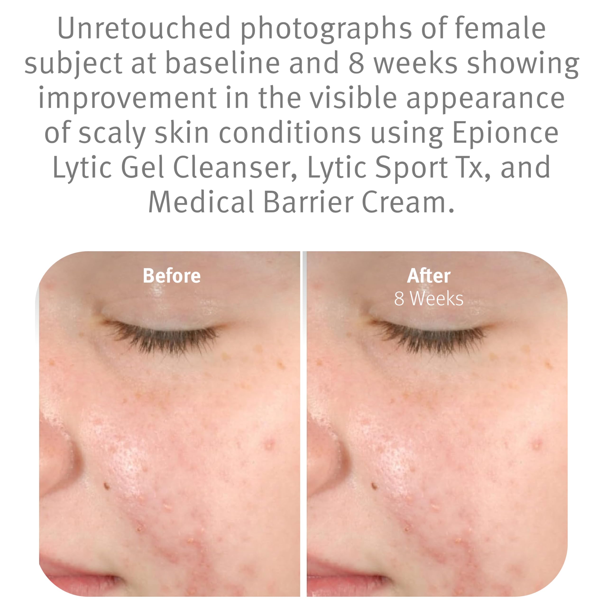 Epionce Lytic Gel Cleanser dirt-oil-dissolution removes impurities without residue