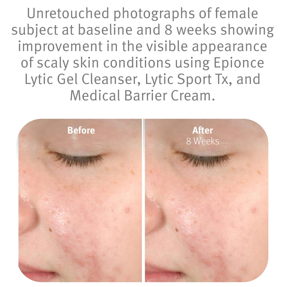 Epionce Lytic Gel Cleanser dirt-oil-dissolution removes impurities without residue