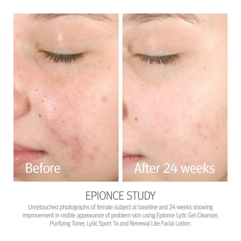 Epionce Purifying Toner with willow bark ingredient for refined pores