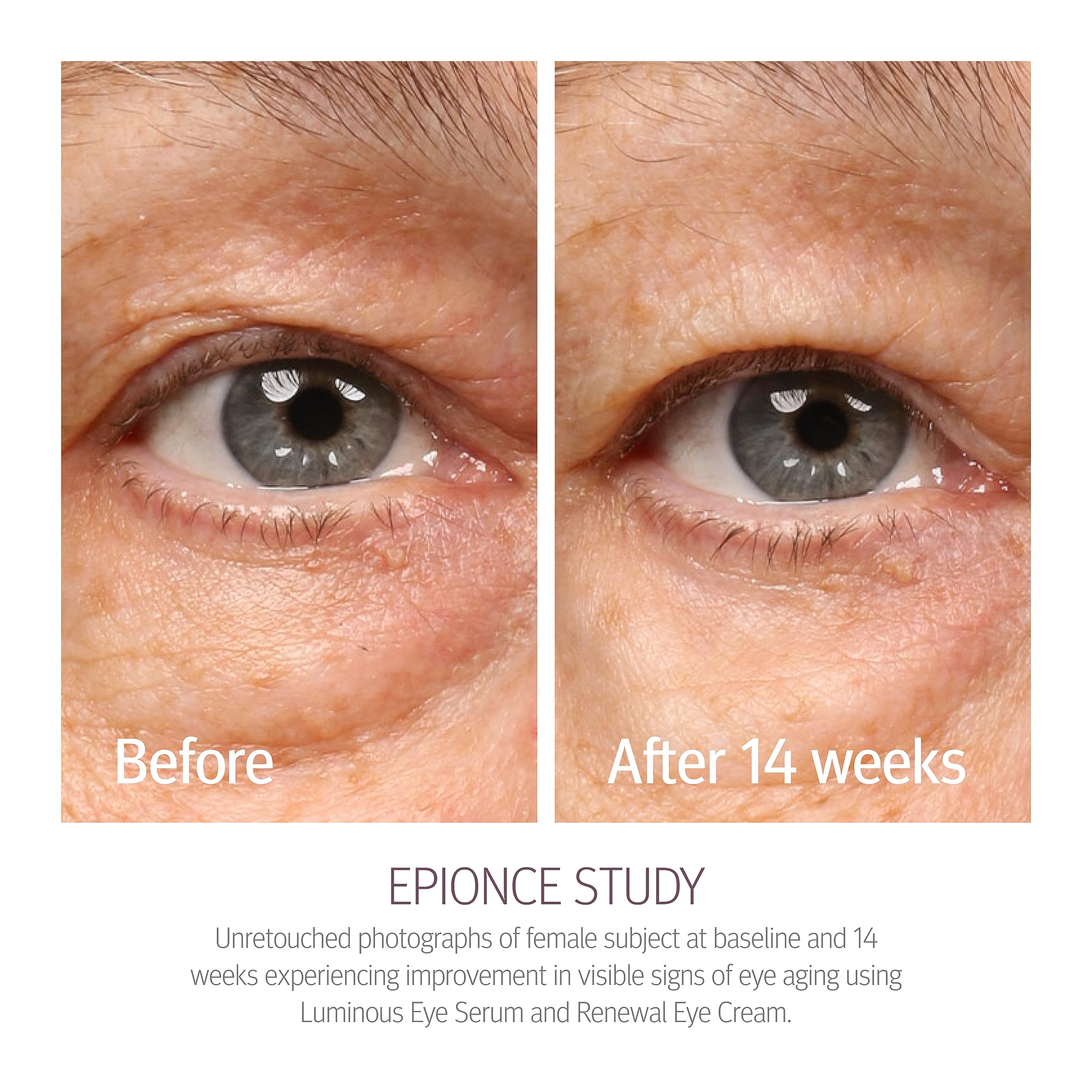 Epionce Renewal Eye Cream packaging-highlights non-greasy finish for all skin types.