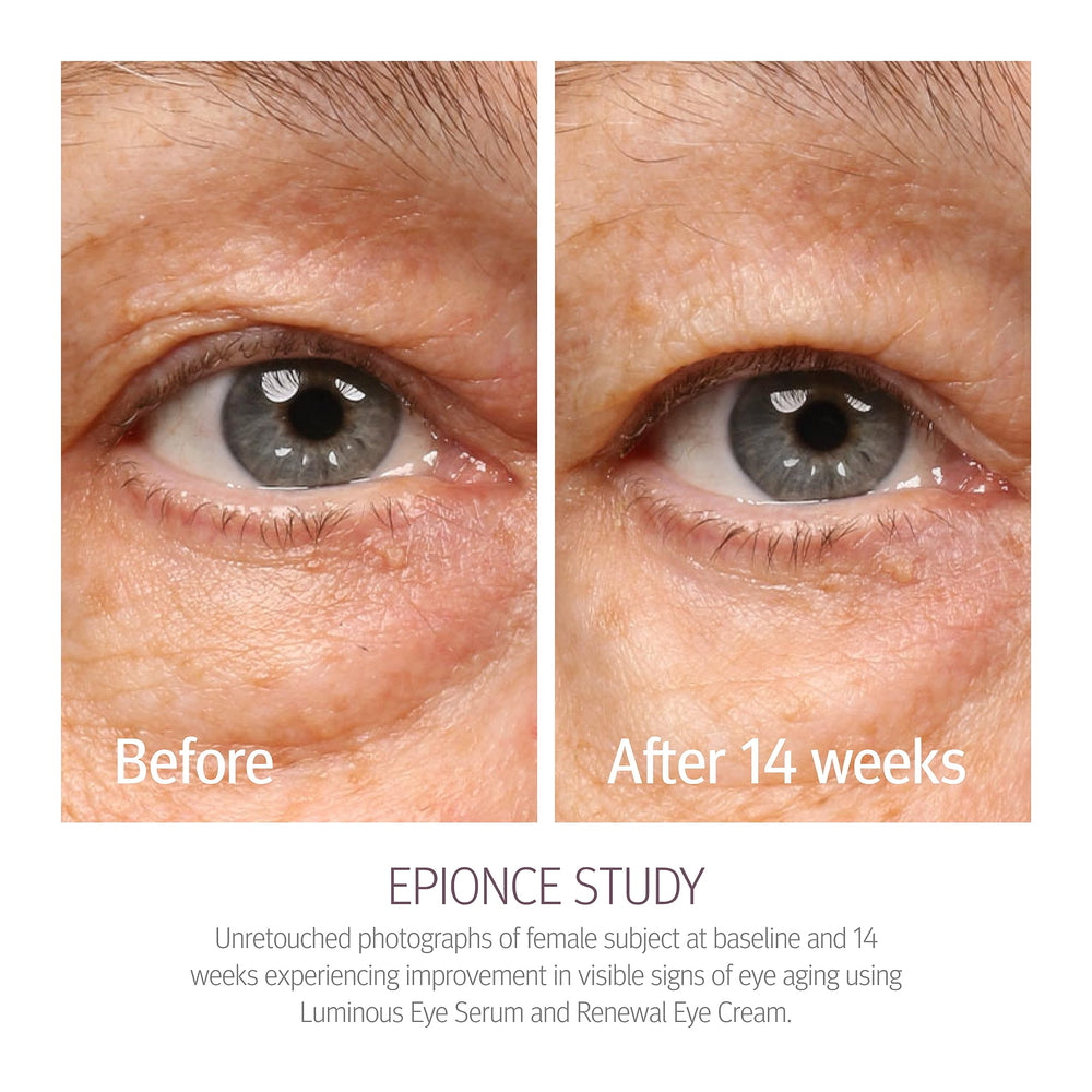 Epionce Renewal Eye Cream packaging-highlights non-greasy finish for all skin types.