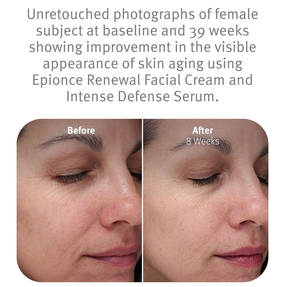 Epionce Renewal Facial Cream being rubbed into skin demonstrates smooth application