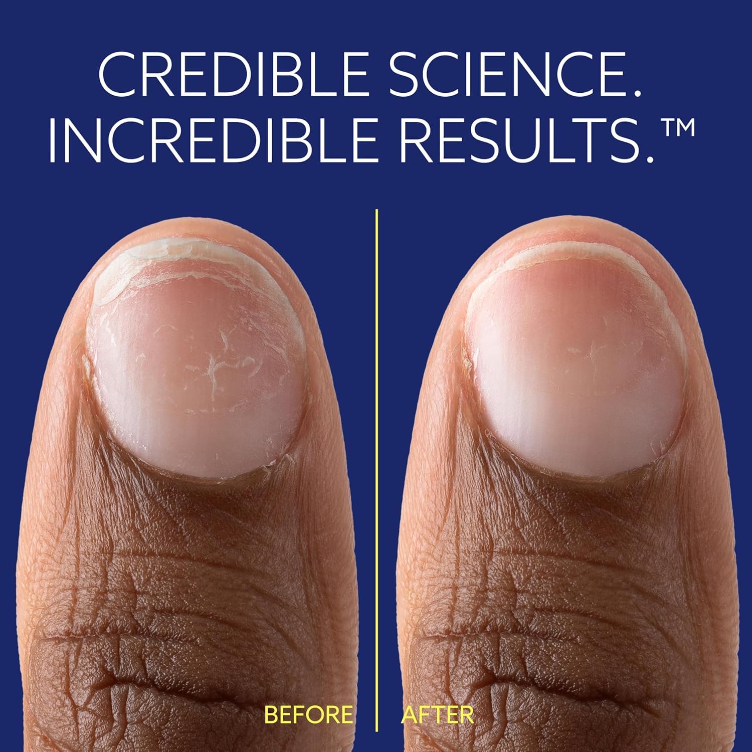 epres ePhD Bond Repair Nail on nails demonstrates natural look without polish.