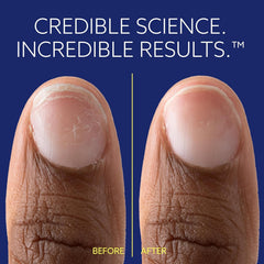 epres ePhD Bond Repair Nail on nails demonstrates natural look without polish.