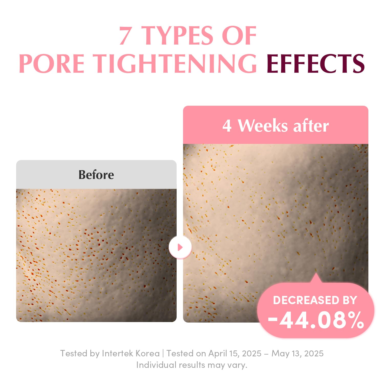 EQQUALBERRY gentle gel pad design reduces irritation with cooling feel