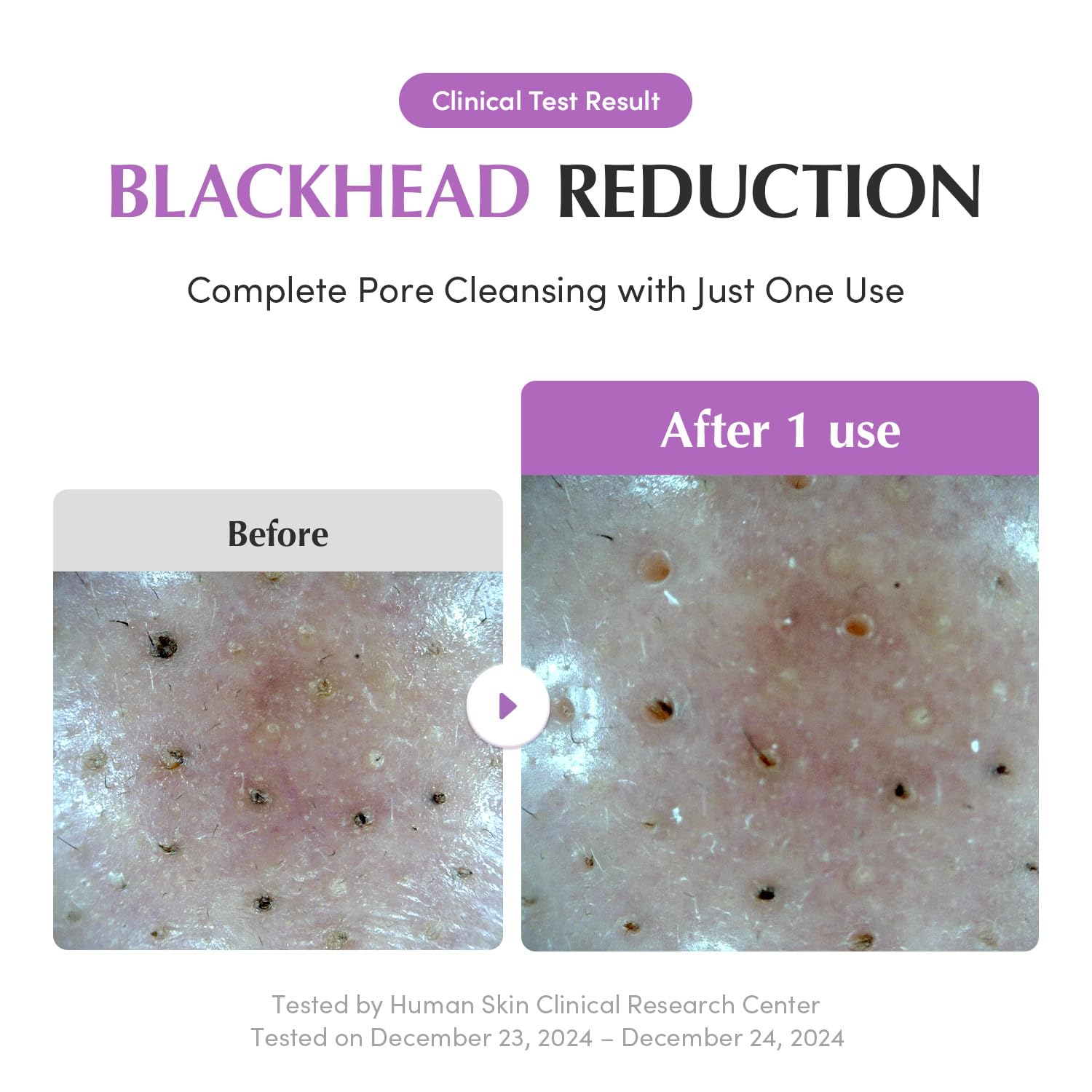 EQQUALBERRY Hyaluronic acid and ceramides moisturize after cleansing