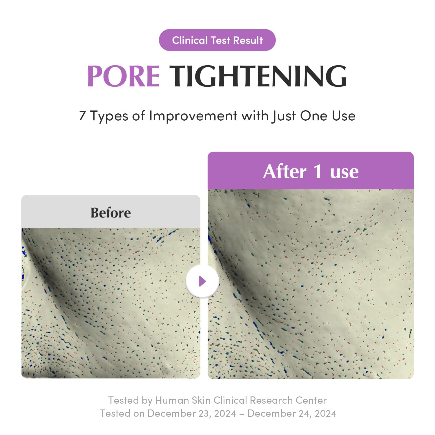 EQQUALBERRY Purple Rice antioxidant-rich formula highlighting pore refinement