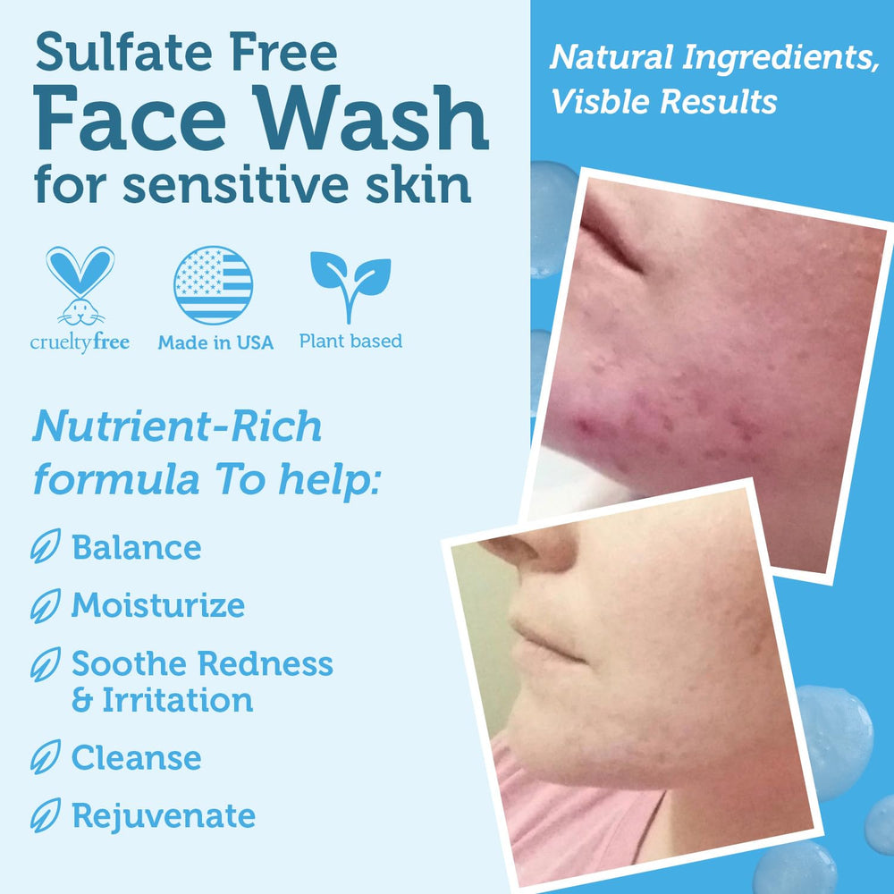 Era Organics Manuka Honey Face Wash with Cehami extract helps calm distressed skin.
