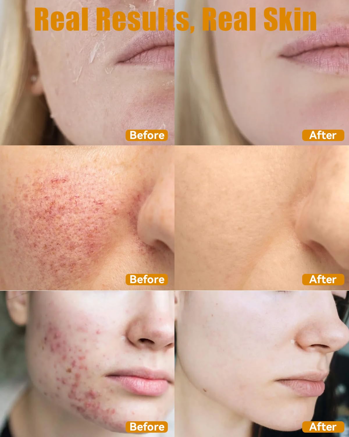 ESAWFVL all-skin-types skin swatch demonstrates gentle hydration and compatibility.