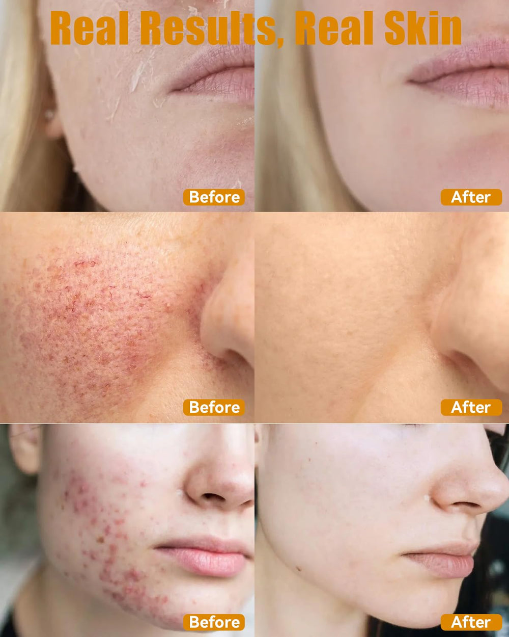 ESAWFVL all-skin-types skin swatch demonstrates gentle hydration and compatibility.