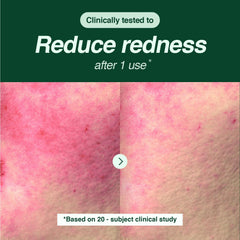 ESSENHERB Tea Tree Foam Cleanser texture on skin highlights hydrating daily cleanse.