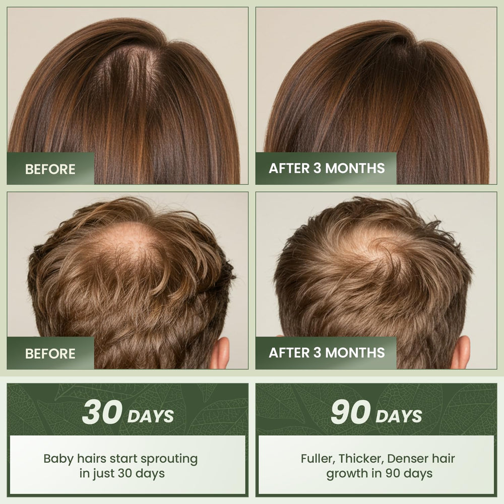 EssyNaturals oil with castor oil supports stronger strands and sheen