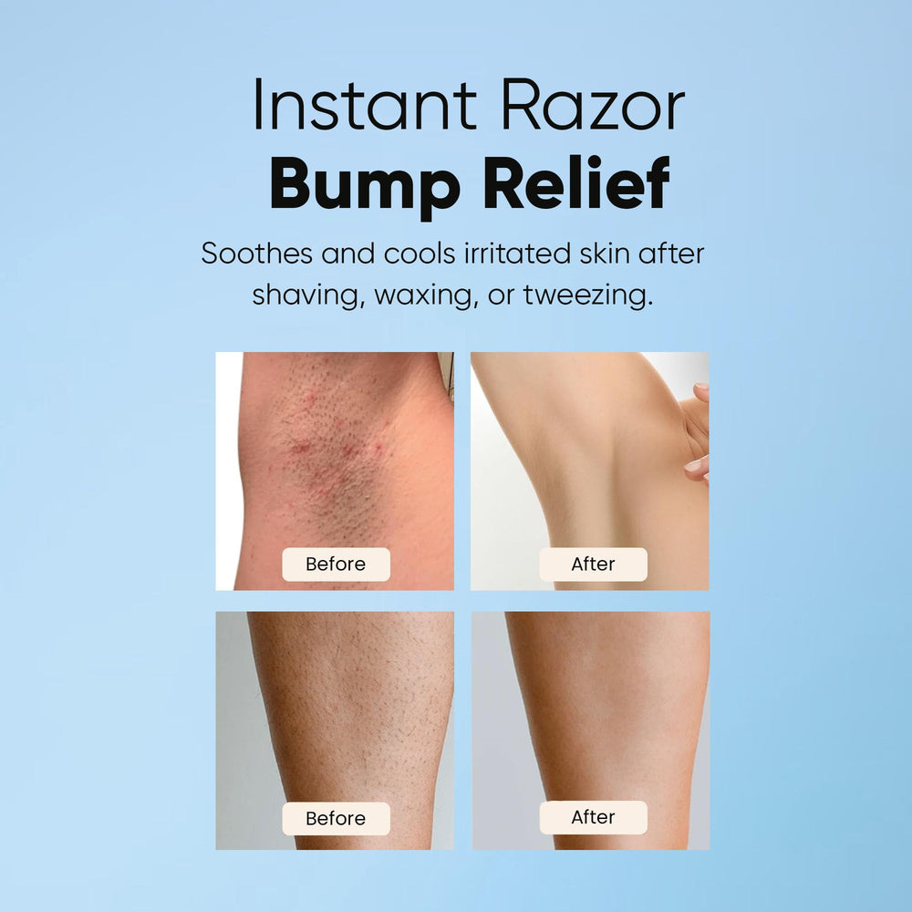 ESTETIST Razor Bump Roll-On face close-up showing calm, even-toned skin