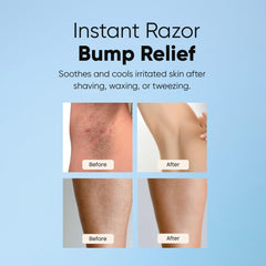 ESTETIST Razor Bump Roll-On face close-up showing calm, even-toned skin