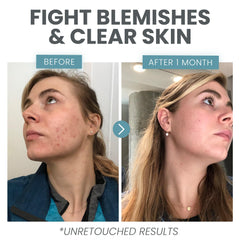 Eva Naturals serum targets dark spots, evening tone for clearer skin.