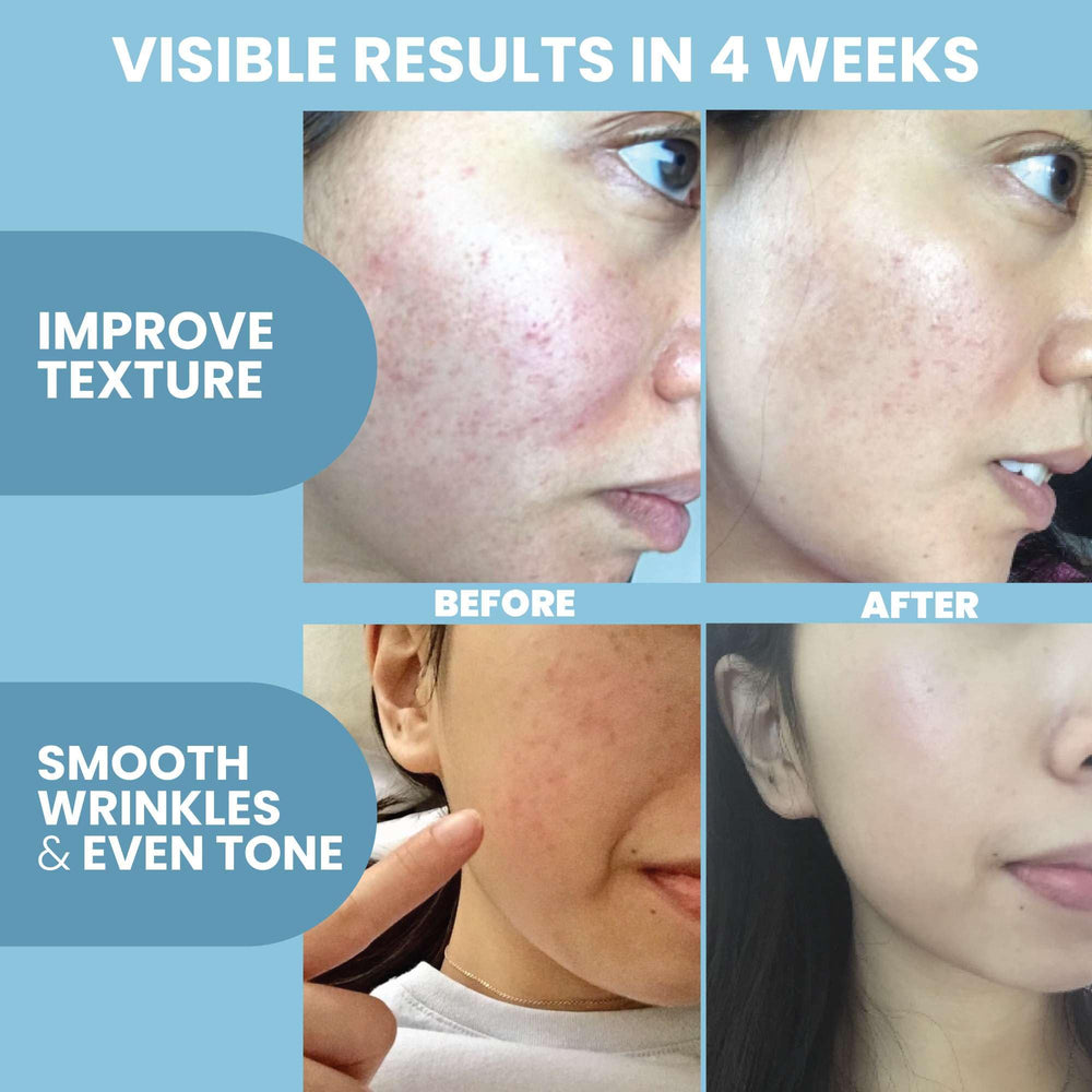 Eva Naturals collagen serum image demonstrates compatibility with microneedling devices for absorption.
