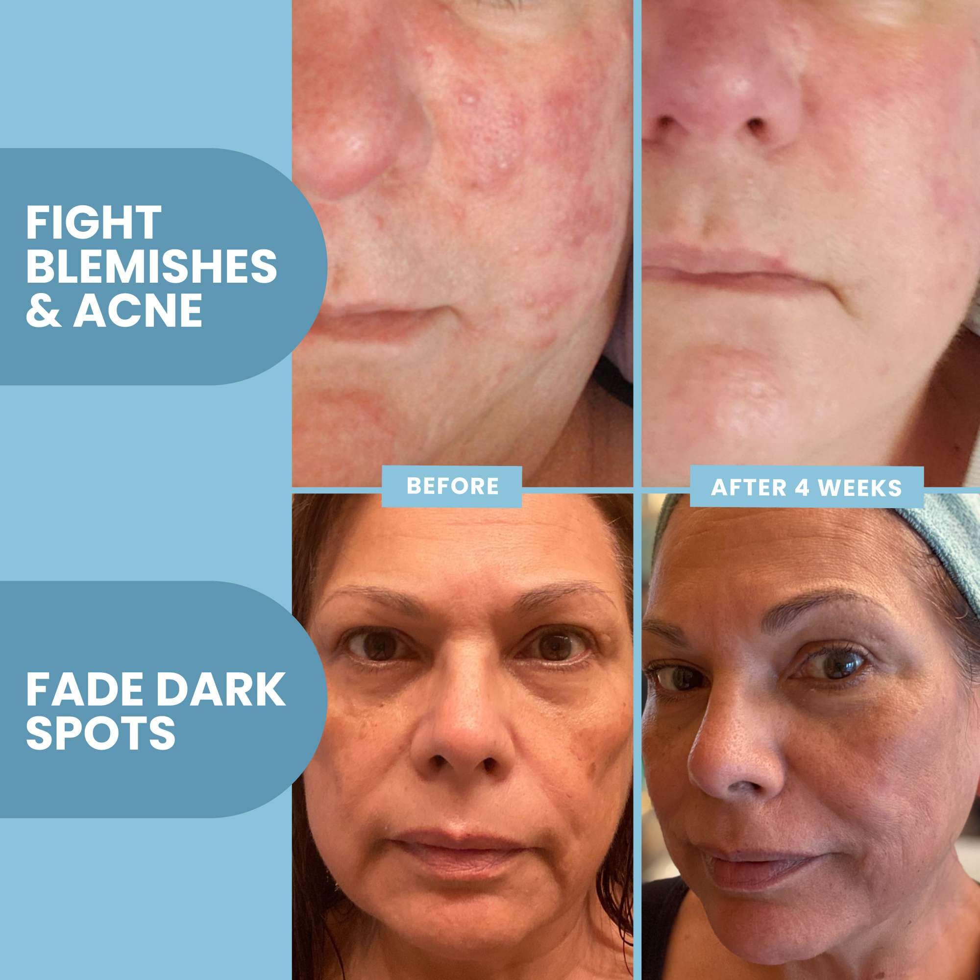 Eva Naturals Vitamin C Serum on skin during application for an even complexion